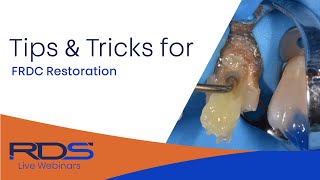 Tips and tricks for fiber reinforced composites [upl. by Ttnerb830]