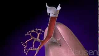 Bronchitis Animation [upl. by Iran]