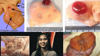 VET ENDO  Corpus Luteum CL Formation amp Regression  Student Output [upl. by Einapets504]