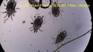 Miracle Under Microscope Grain Mites Move In Aquarium Water [upl. by Acila]