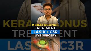 Live Keratoconus Treatment Lasik  C3R [upl. by Emie]