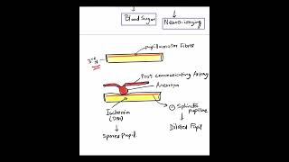 3rd Nerve Palsy  Pupil sparing vs Pupil involving Mustknow Shorts [upl. by Ciri310]