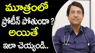 మూత్రంలో ప్రోటీన్ పోతే ఏంచేయాలి  Best Treatment for Proteinuria  Albuminuria  Latest Health tips [upl. by Wershba160]