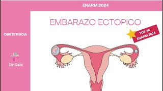 OBSTETRICIA  EMBARAZO ECTÓPICO  ENARM 2024 [upl. by Itisahc]