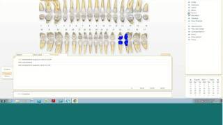 Curve Odontogram [upl. by Lerual516]