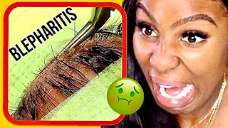 EYELASH EXTENSIONS  HOW TO AVOID EYELID INFECTIONS BLEPHARITIS  CICI MOYA [upl. by Nuahsyar]