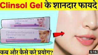 Clinsol gel review in hindi एक्ने पिम्पल ऑयली स्किन के लिए असरदार दवा Clinsol gel uses [upl. by Rowe]