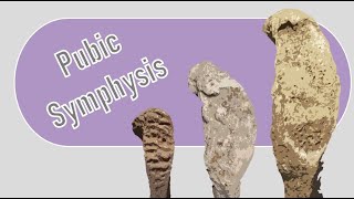 Pubic symphysis aging  Osteology tutorial [upl. by Huggins]