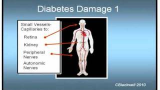 Diabetes 3 Control and Complications [upl. by Atiuqrahc]