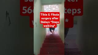 Tibia fibula surgery after 56days upstairs walking  Leg fracture exercises flatfoot [upl. by Petulah808]