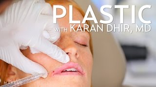 Lip Injections with Filler Bow and Arrow Technique  PLASTIC with Dr Dhir [upl. by Thacher]