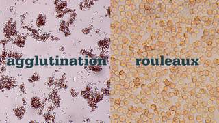 How to Perform a Saline Agglutination Test [upl. by Nolos475]