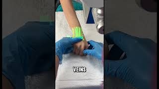 Vein Visualization Revolution [upl. by Anoit557]