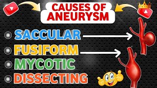 Understanding  Causes Of Aneurysm 😍 [upl. by Peppard]