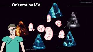 〖Echocardiography〗 All about the mitral valve  Barlows prolapse amp flail leaflet 💖 [upl. by Slen]