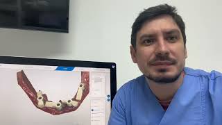 Full arch  all on x  scanning using Primescan normal scan abutments VS smartflags [upl. by Graig]