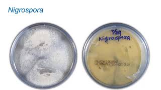 Identification of Melanized Dermatitiaceous Fungi Part 1 Hot Topic [upl. by Adirehs]