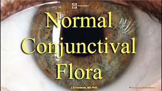 Normal Conjunctival Flora [upl. by Aniv]