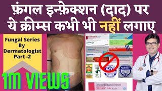 Ringworm Fungal Infection Treatment In Hindi  Fungal Infection Cream Without Steroids  Dr Sunil [upl. by Ferriter]