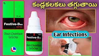 Festive Dee Eye and Ear drops in telugu Best drops for Eye and Ear Infections [upl. by Llabmik]