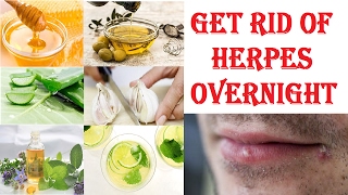 How To Cure Herpes Overnight  Natural Home Remedies For Removal Of Herpes [upl. by Leboff]