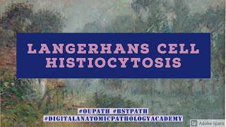 Langerhans Cell Histiocytosis [upl. by Four]