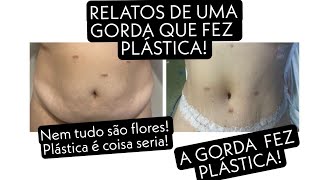 Vlog sobre minha abdominoplastia Um gorda que fez abdominoplastia nem tudo são flores [upl. by Breech577]