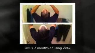 HairFuelOnline  Baldness Cure Hair Loss Cure ZX42 consumer reports philadelphia hair loss treatment [upl. by Kelila106]