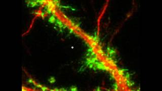 Local collapse and regrowth of dendritic Factin following glutamate [upl. by Marve]