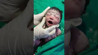 Essential care of new born baby after birth viralvideo littleprince mylittleprince mylittle [upl. by Erle137]