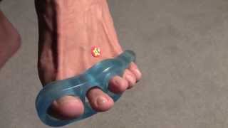 Running Insoles Evaluation  other Mortons Neuroma Remedies [upl. by Ettenal]