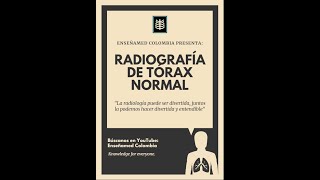 Radiografía de Torax Normal Los detalles de lo simple [upl. by Atila]