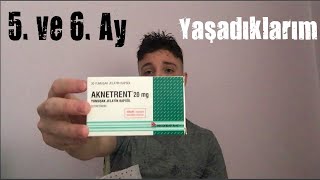 Zoretanin Aknetrent 5 ve 6 Ay Yaşadıklarım ve Leke Tedavisi  Roaccutane [upl. by Vincenta998]