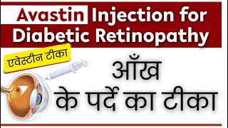 How Avastin Injection Helps Save Vision A CostEffective Solution  AvastinInjection [upl. by Britni]