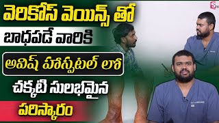 Best Varicose Veins Treatment In Telugu  How to Get Rid Varicose Veins In Telugu  SumanTV Prime [upl. by Lipman]