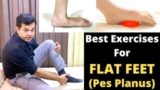 Treatment For Flat Feet Pes Planus Flat Foot Exercises Foot Pain Treatment Foot Arch Exercises [upl. by Diane]