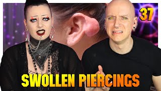 Reacting To Piercing Keloids amp Hypertrophic Scars ftToxic Tears  Piercings Gone Wrong 37  Roly [upl. by Karylin]