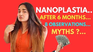 Results of Nanoplastia after 6 months 🫢  Which Shampoo to use 😧  Hair fall   Detailed Review [upl. by Payson]