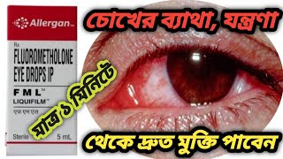 FML eye drops benefits use in bengali review How to benefits in FML eye drops [upl. by Allenrac]