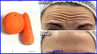 Her real age is 90 but look 19 using orange remedy to remove forehead wrinkles naturally forever [upl. by Ilram]