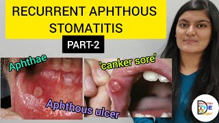 RECURRENT APHTHOUS STOMATITIS RAS PART 2 [upl. by Anitnauq797]