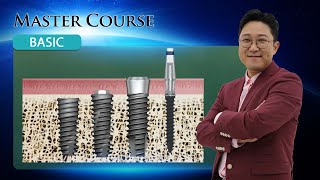 Master Course  BASIC Implant Components [upl. by Reld]