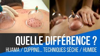 Hijama  Cupping therapy  Technique quotsèchequot ou quothumidequot Quelle différence [upl. by Edrei753]