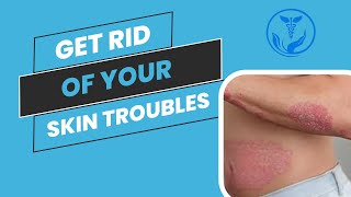 GET RID OF YOUR SKIN RASH  BEST WAY TO VANISH UR SKIN DISEASES  Homeopathy with Dr Anoosha Hashmi [upl. by Litsyrk97]