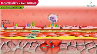 Inflammatory Bowel Disease Pharmacology Lectures [upl. by Assetnoc]