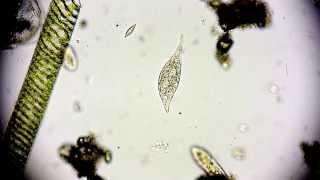 Amphileptus meleagris  Ciliate  Wimpertierchen  Hemiophrys meleagris  microorganisms microscope [upl. by Aikkan]