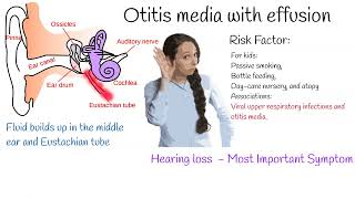 Otitis media with Effusion  Most common cause of hearing loss in kids [upl. by Malley926]