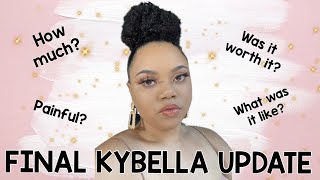 Final Kybella Update  Everything you need to know before you go [upl. by Quiteris916]