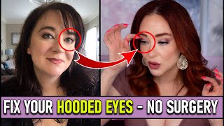 No More Sagging Eyelids at 47 No Surgery or Procedures Fix Hooded Eyes [upl. by Nuawed]