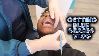 GETTING BLUE BRACES ft SoloEntertainment [upl. by Rissa]